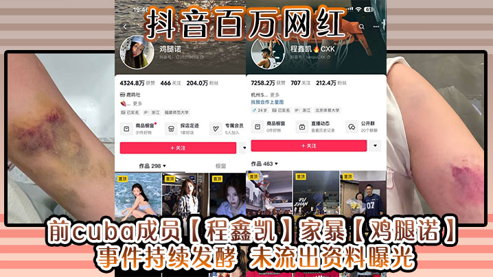 抖音百万网红 前cuba成员【程鑫凯】家暴【鸡腿诺】事件持续发酵 未流出资料曝光!